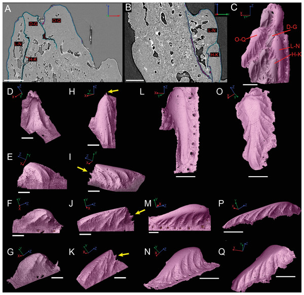Virtual thin sections of the Lophosteus (GIT 727-2) spine taken in (A) frontal and (B) sagittal planes and a (C) 3D rendering of the entire area with odontodes (D–Q) marked to show position to each other.
