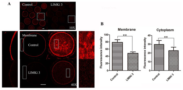 LIMKi 3 treatment causes disruption of actin distribution in porcine oocyte.