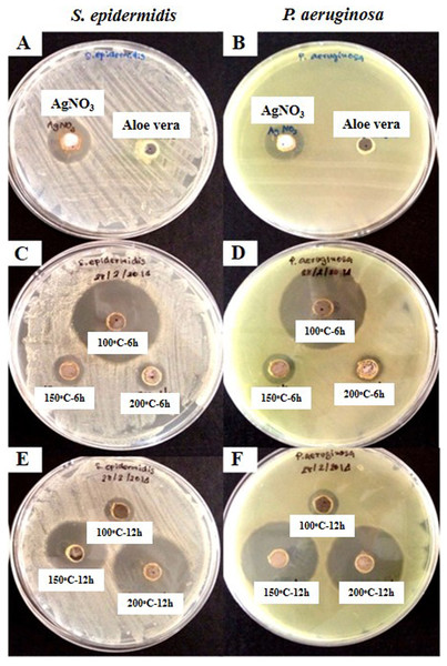Antibacterial activity assay of AgNPs against S. epidermidis and  P. aeruginosa.