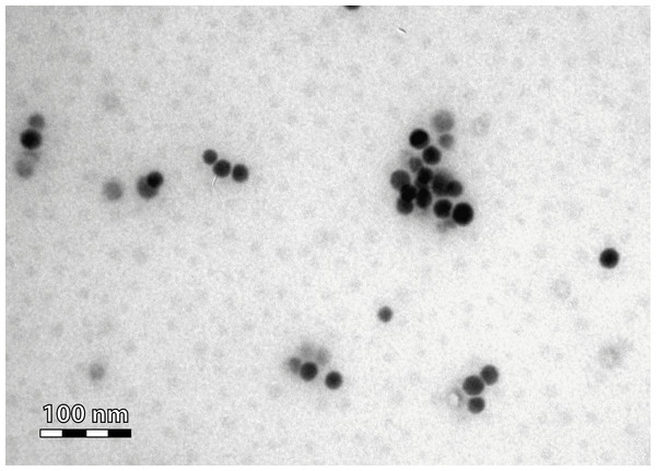 TEM micrograph of the administered Se nanoparticles.