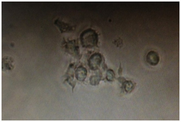 Dendritic cells acquired after flow sorting with typical dendritic protrusions on the cell surface.