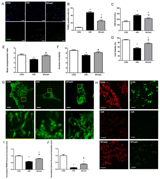 SPostC decreased LDH level, cell death and cell viability, increased mitochondrial interconnectivity, elongation and membrane potential but decreased the opening sensitivity of mPTP on post-hypoxic primary cultured neonatal rat cardiomyocytes (NCMs).