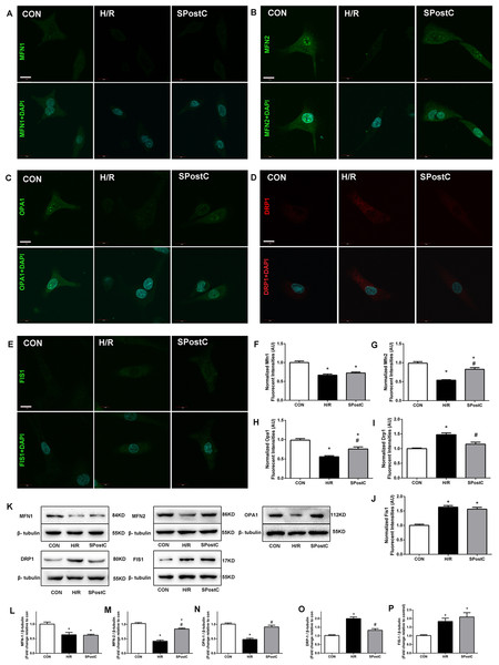 Effect of SPostC on mitochondrial fusion and fission protein expression after H/R injury.