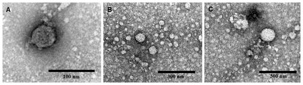 Electron micrographs of negatively stained nucleocapsid-like particles (NLPs) produced from truncated HCV core protein at pH 12.