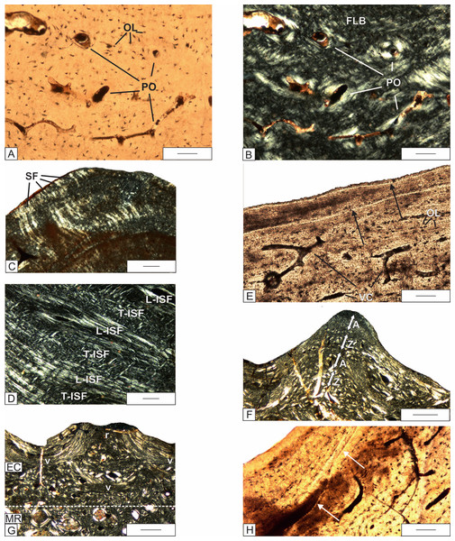 Histology of the external cortex of the skull bones of Metoposaurus krasiejowensis (UOPB 01029) from the Late Triassic of Poland.