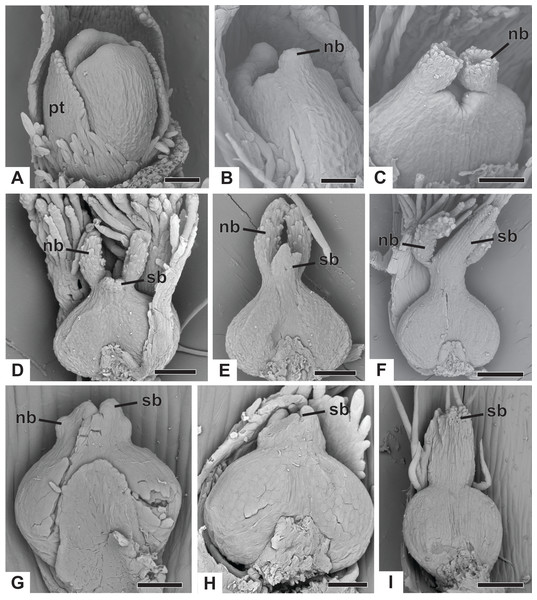 Successive developmental stages of pistillate flowers of dimerous species of Paepalanthus (SEM).