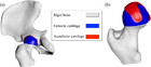 Probabilistic biomechanical finite element simulations: whole-model ...