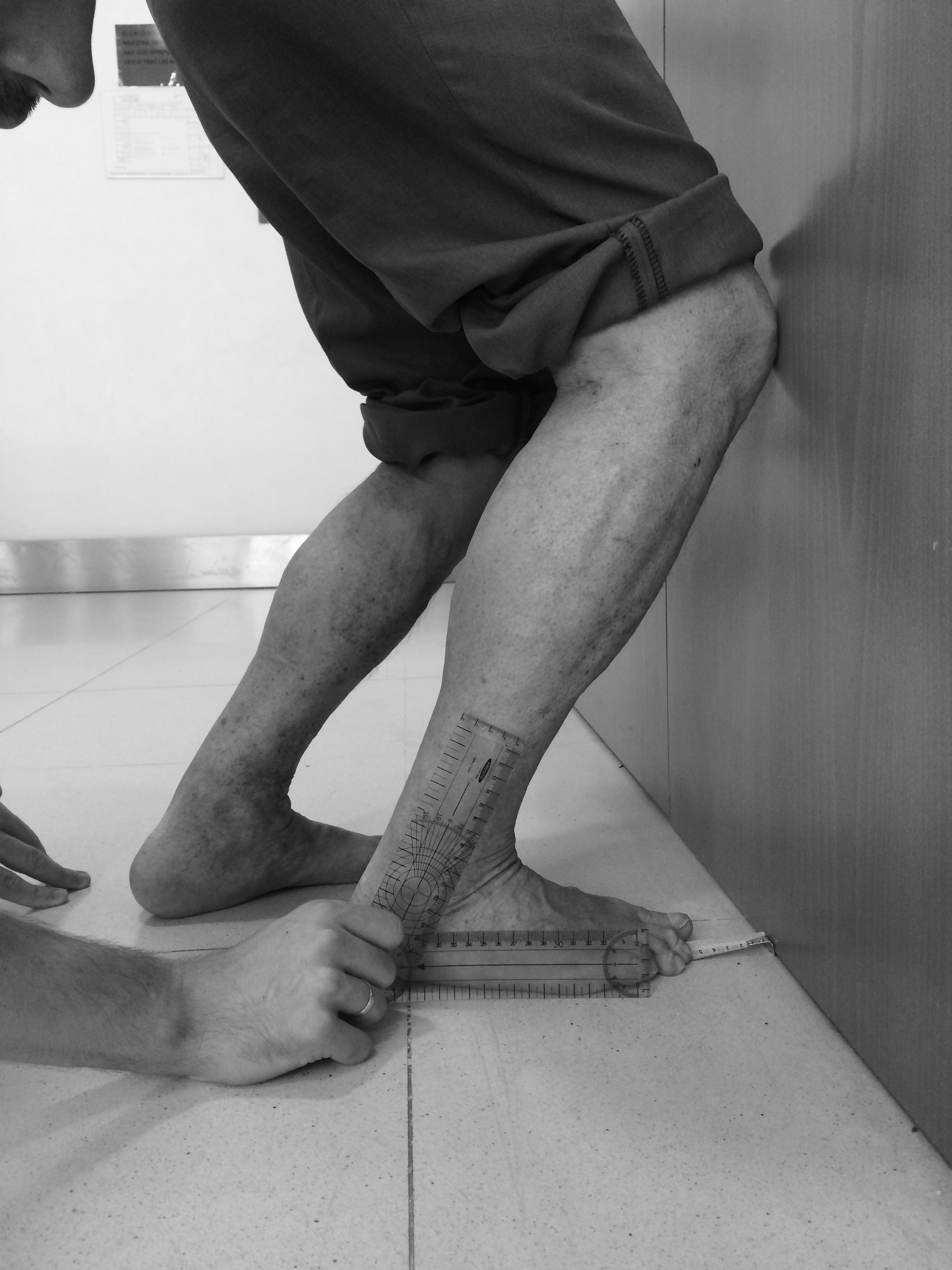 The concurrent validity and reliability of the Leg Motion system
