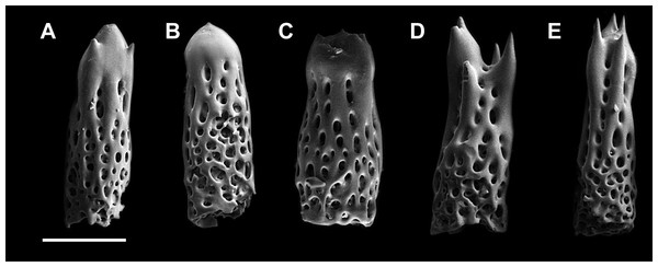 Abactibal spines of the paxillae located at the base of ray.