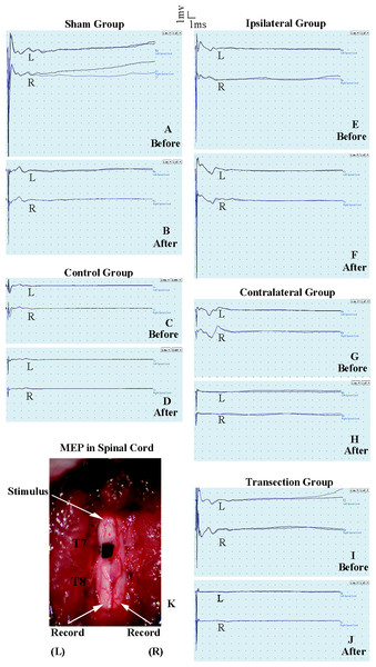 Electrophysiological examinations of the spinal cord in first part of this study before and after the second hemisection operation at T7.