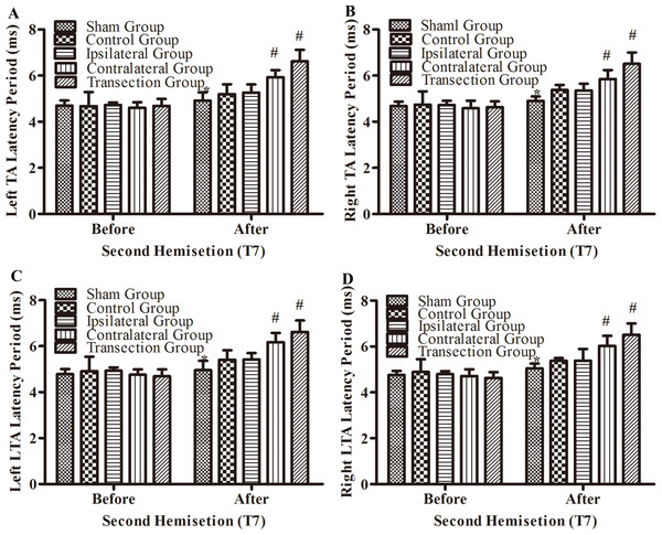 Electrophysiological examinations (MEP, latency periods) in body surface in part 1 part of this study before and after the second hemisection operation at T7.