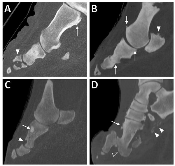 Sagittal CT slices of digits in elephant feet, exhibiting pathological changes.