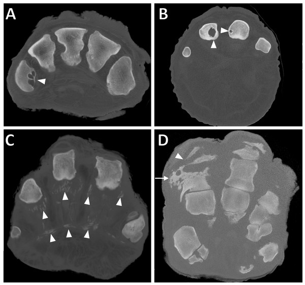 Transverse CT slices of digits in elephant feet, exhibiting pathological changes.