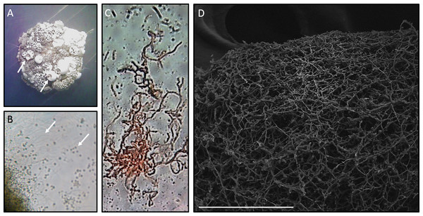Microscopy of Streptomyces sp. H-KF8.