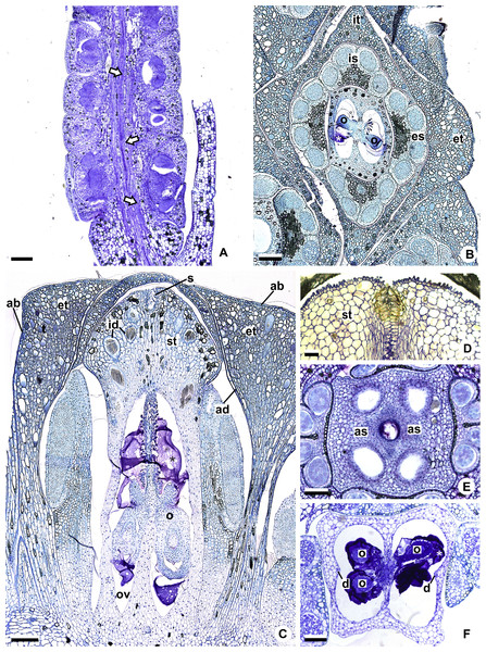 Floral anatomical aspects of species of Anthurium, based on longitudinal (A, C, D) or transverse sections (B, E, F).