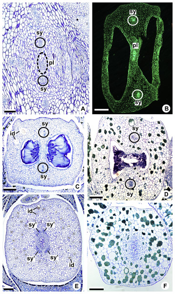 Floral vasculature of species of A. sect. Urospadix (A, D, F), A. sect. Pachyneurium series Pachyneurium (B, E) and A. sect. Dactylophyllium (C), in transverse sections of flowers at female anthesis.