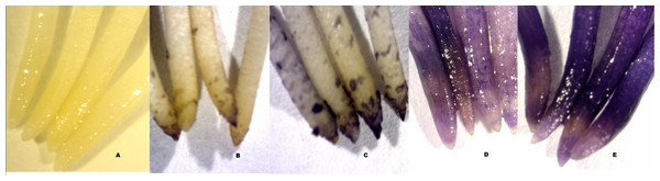 Haematoxylin staining of root tips of faba bean.