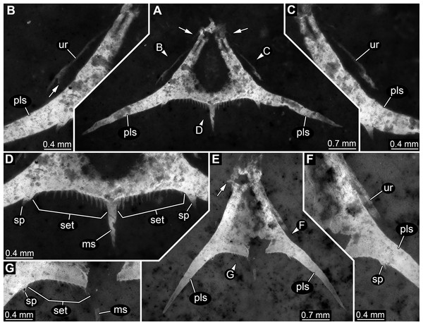 Specimens 2 (SMNS 70353/2) and 3 (SMNS 70353/3), each representing an isolated posterior part of a pleotelson (=telson) composite-fluorescence micrographs.