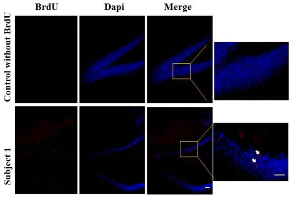 Neurogenesis in dentate gyrus by exercise induced.