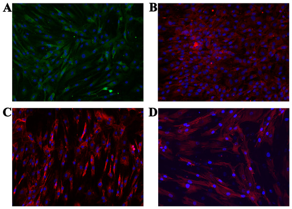 Micrographs of the stained samples: (A) for ACAN, (B) for COL2 and (C) COL1. Additionally, (D) shows the cells with a stained cytoskeleton (actin).