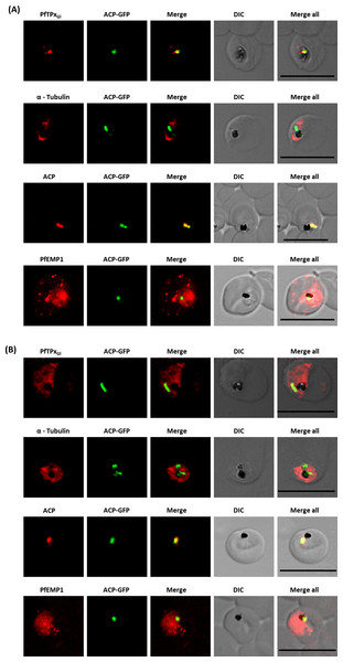 Immunofluorescence images show PfTPxGl, microtubules, ACP-GFP, PfACP and PfEMP1 trafficking in vinblastine-treated D10-ACPleader-GFP parasites.