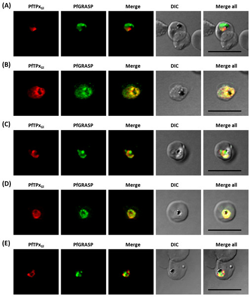 Immunofluorescence images showing the Golgi morphology in AlF4− and vinblastine treated parasites.
