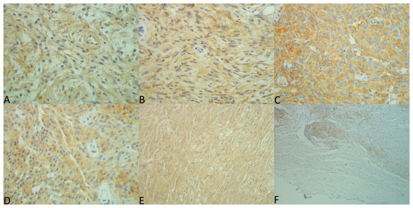 Expression patterns for each antibody.