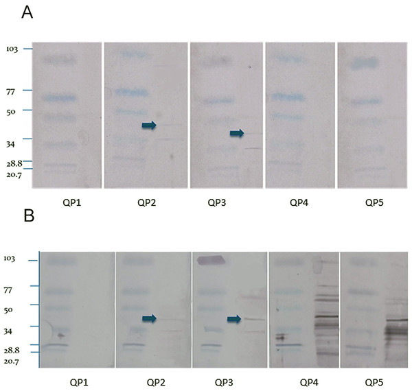 Western blot.