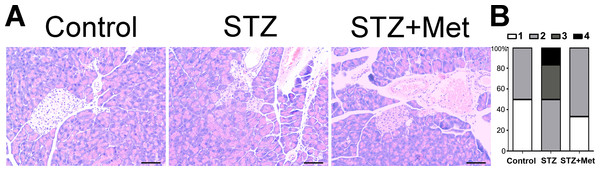 Effect of metformin treatment in STZ-induced diabetic mice on insulitis in pancreatic islets