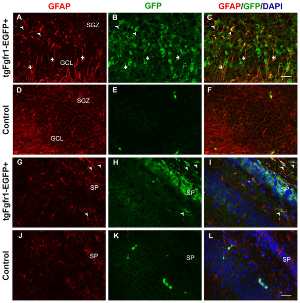 Fgfr1 expression in GFAP+ cells of the hippocampus at P7.