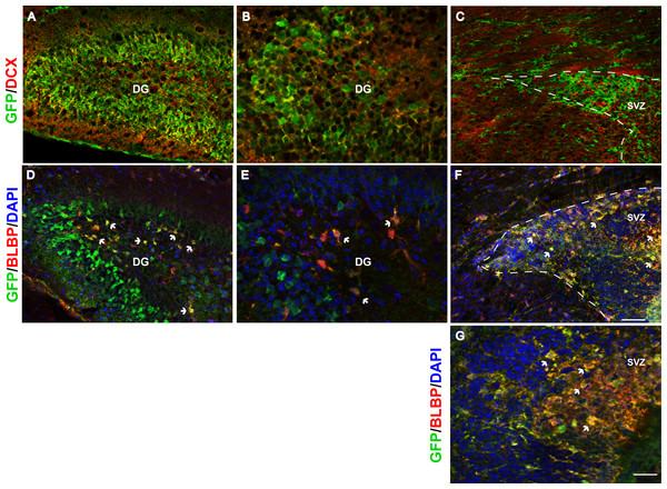 Fgfr1 expression in neuroblasts of the hippocampus, and stem cells of the hippocampus and SVZ at P7.