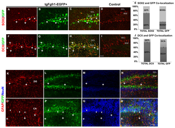 Fgfr1 expression in the dentate gyrus and CA of 1-month mice.