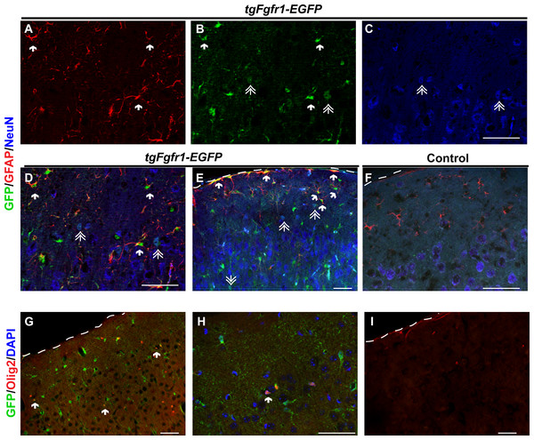 Fgfr1 expression in the cortex of 1-month mice.