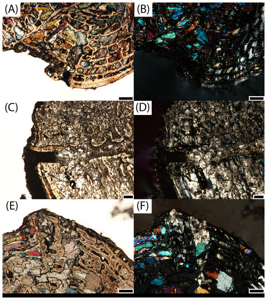 Microphotographs of nutrient foramina in transverse profile.