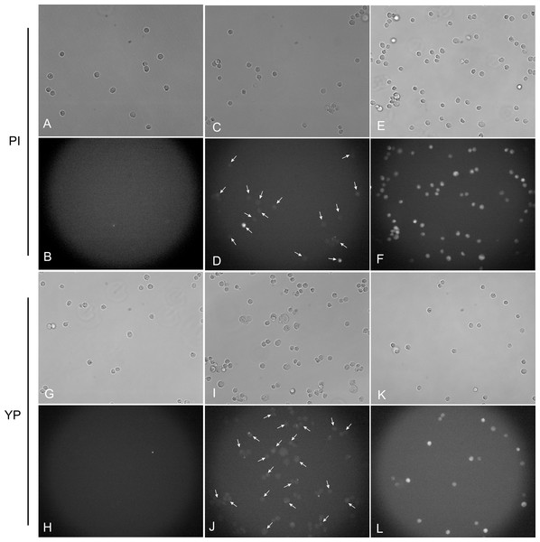 Light and fluorescence microscopy images using PI and YP fluorescent dye assays.