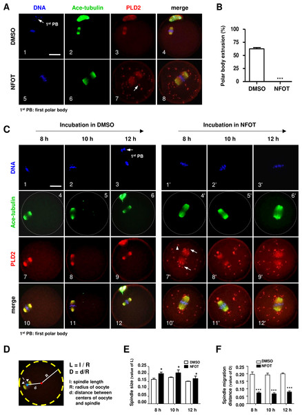PLD2 inhibition resulted in center-positioned spindle and arrested meiotic progression.