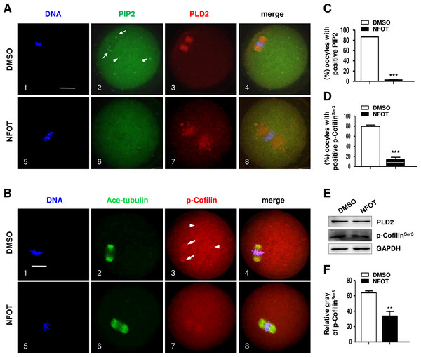 PLD2 inhibition destroyed polar recruitment of PIP2 and p-CofilinSer3.