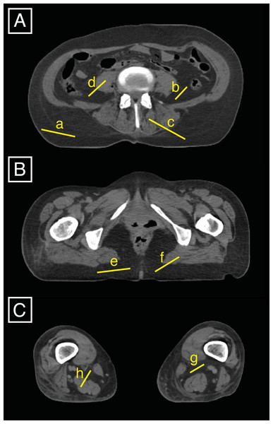 Three slices (A is between the 4th and 5th lumbar vertebrae, B is at 85% of the maximum femoral length, and C is at 15% of the maximum femoral length) were used to set the AT upper density limit by averaging eight specific upper density limits that can be displayed in FIJI by drawing lines (a to h) on the slices and displaying the related histograms.