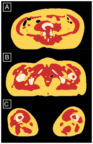 Classified AT (red) and LT (yellow and white) exemplified on the slices located between the 4th and 5th lumbar vertebrae (A), at 85% of the maximum femoral length (B) and at 15% of the maximum femoral length (C).