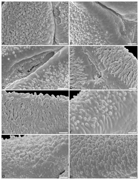 SEM micrographs of fossil Loranthaceae pollen with affinity to Elytrantheae and extant representatives.