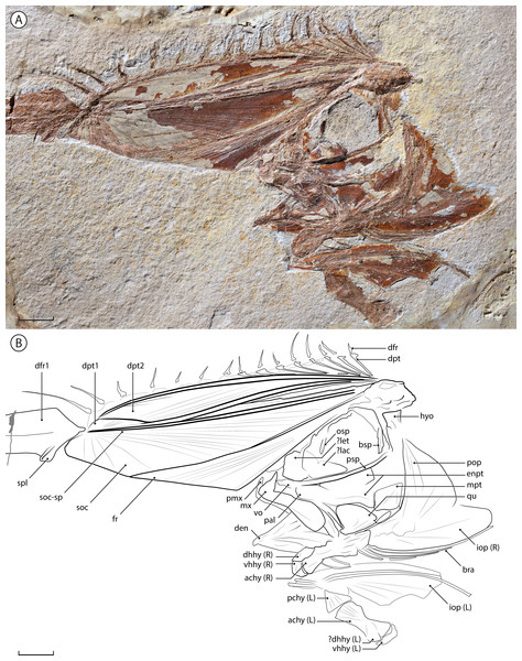 †Babelichthys olneyi, gen. et sp. nov. holotype MNHN.F.EIP11d.