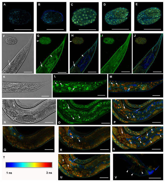 Analysis of GFP::F28F8.5 expression in homozygous animals with edited F28F8.5 gene by confocal microscopy and fluorescence lifetime imaging microscopy (FLIM).
