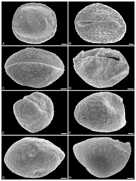 SEM micrographs of Saururus tuckerae pollen from the middle Eocene (c. 48 Ma) of Princeton, B.C., western Canada
