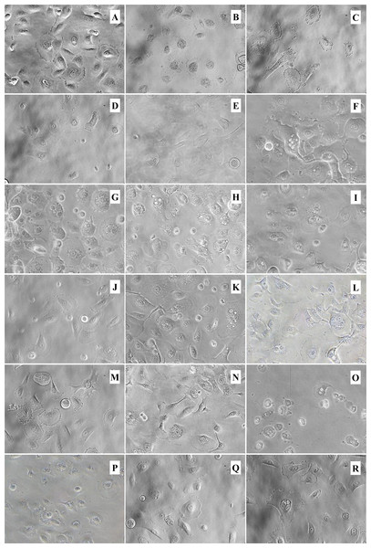 Morphology of inflammation-induced tonsil epithelial cells treated with the ethanol extracts.