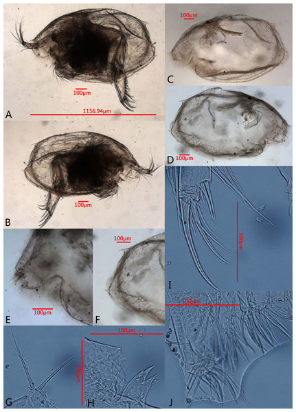 Photomicrographs of Euphilomedes biacutidens sp. nov., ♂.