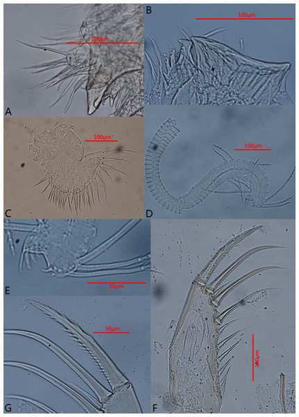 Photomicrographs of Euphilomedes biacutidens sp. nov., ♂.