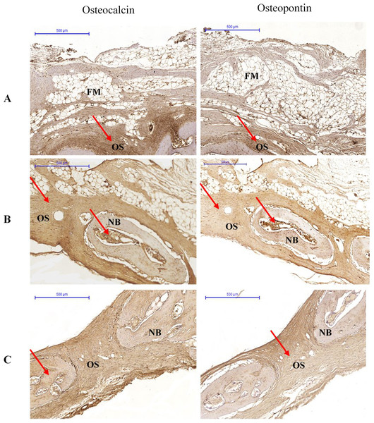 Photomicrographs of immunostaining for osteocalcin and osteopontin in (A) Group I, (B) Group II (C) Group III at 6 weeks.