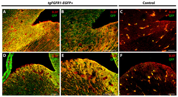 Fgfr1 is expressed in the LGE and lateral pallial-subpallial boundary at E14.5.