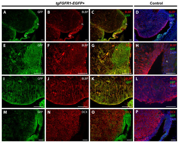 Fgfr1 is expressed in the cerebellar anlage at E14.5.