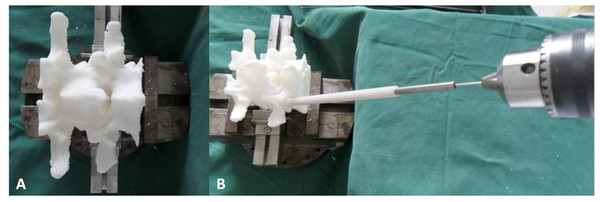The 3D-printed lumbar model was fixed at the base of support on the table (A).